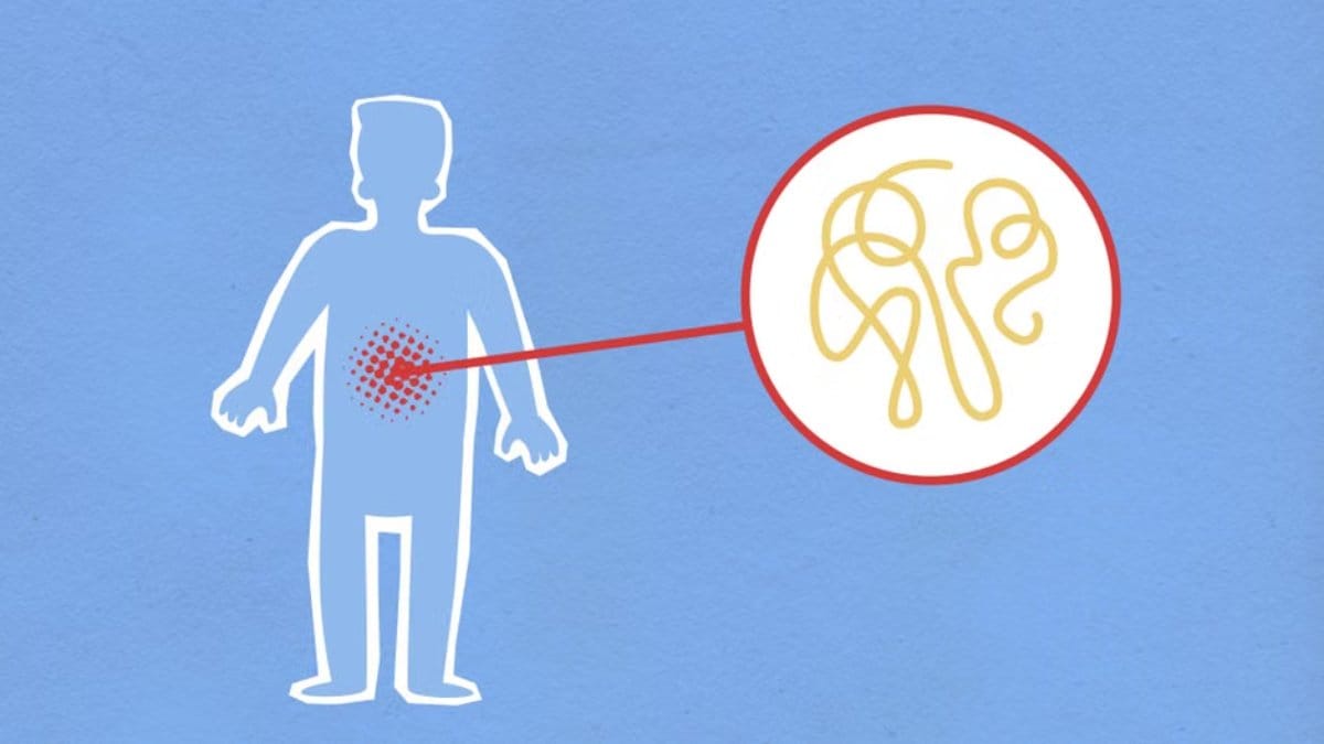 Understanding Probiotics: The Basics
